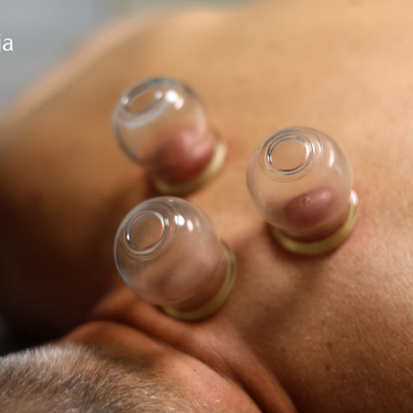 Kurs Terapia bańkami