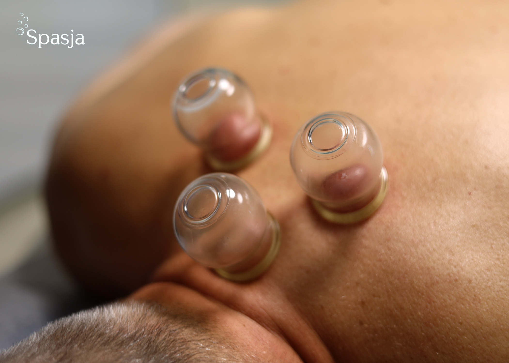 Kurs Terapia bańkami