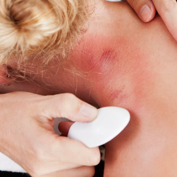 Gua Sha w fizjoterapii