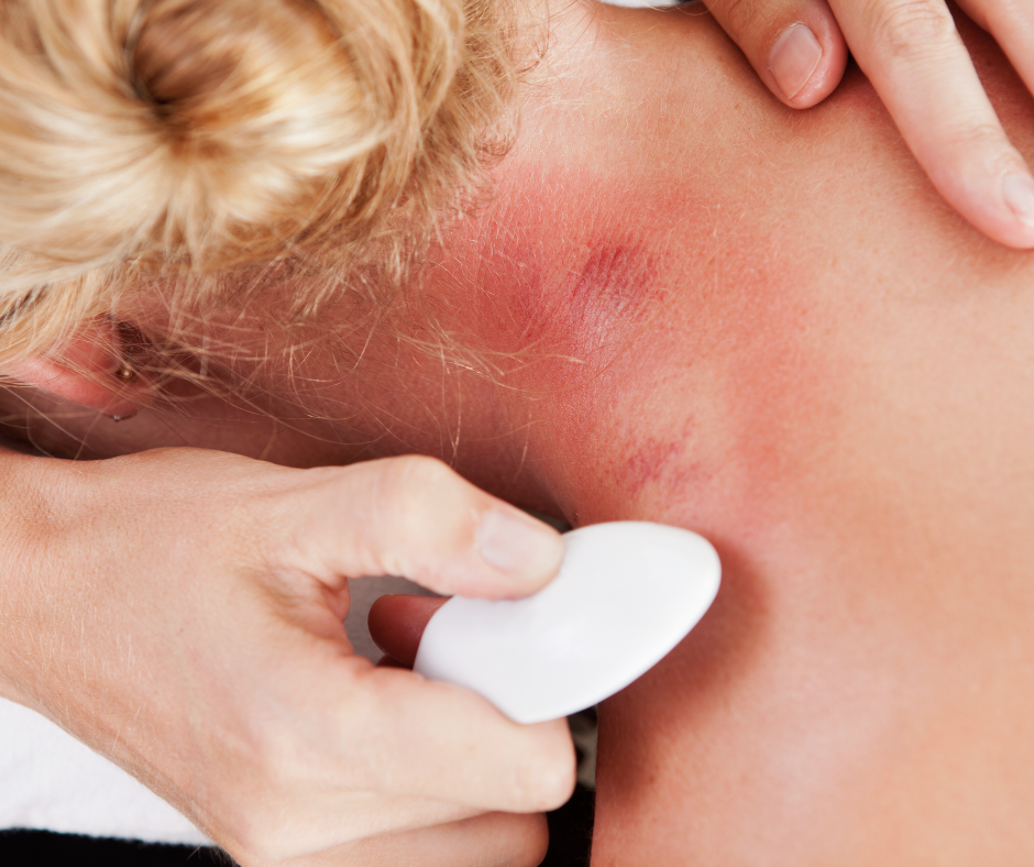 Gua Sha w fizjoterapii